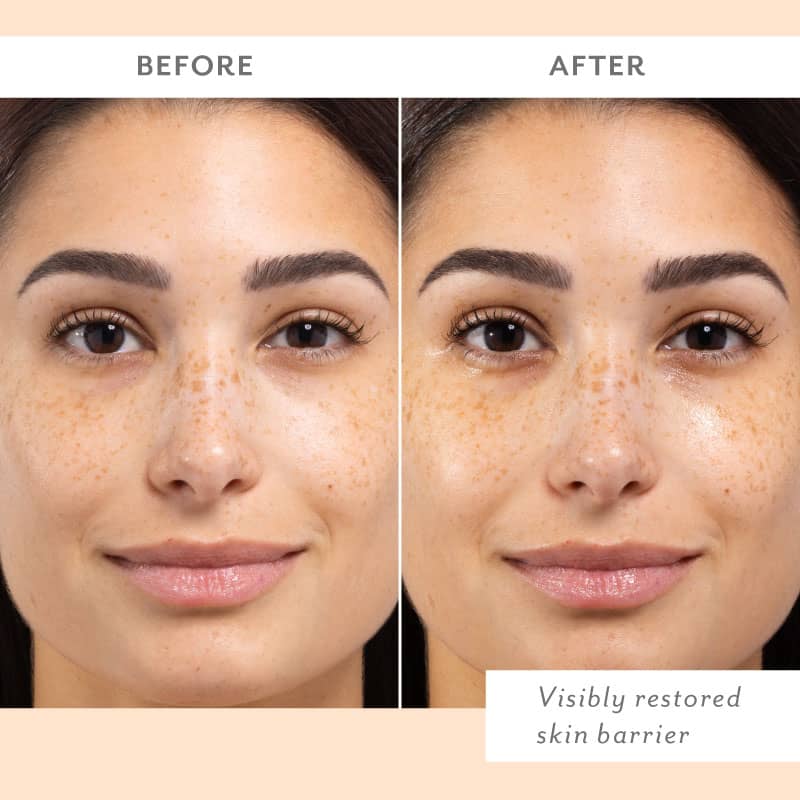 Skin Remedy Barrier-Boosting Sheet Face Mask